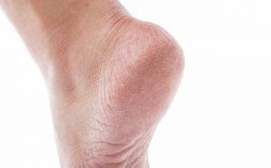 Pourquoi rêver de pieds abîmés ?