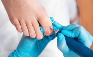 Rêver d'ongles incarnés : quelles interprétations, symbolisme et significations ?