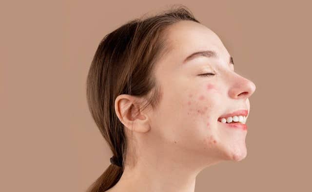 Pourquoi rêver de boutons sur le corps ?